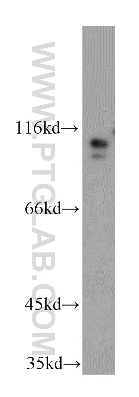 Western Blot (WB) analysis of HEK-293 cells using USP33 Polyclonal antibody (20445-1-AP)