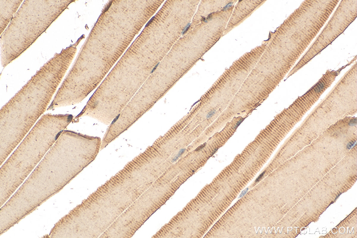 Immunohistochemistry (IHC) staining of mouse skeletal muscle tissue using USP35 Polyclonal antibody (24559-1-AP)