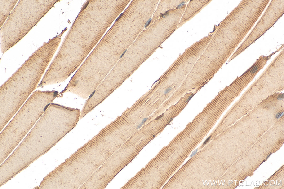 Immunohistochemistry (IHC) staining of mouse skeletal muscle tissue using USP35 Polyclonal antibody (24559-1-AP)