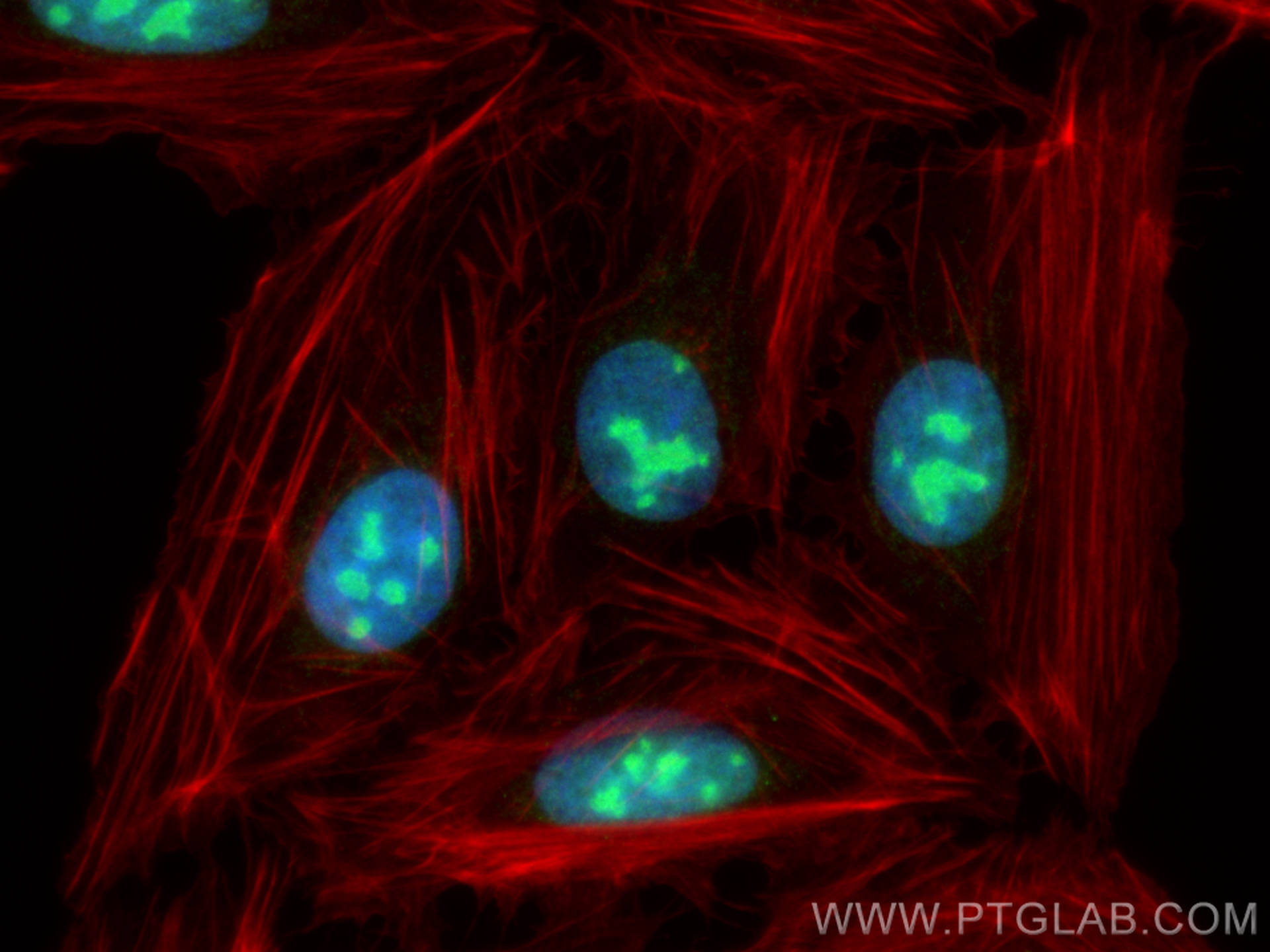 Immunofluorescence (IF) / fluorescent staining of U2OS cells using USP36 Polyclonal antibody (14783-1-AP)