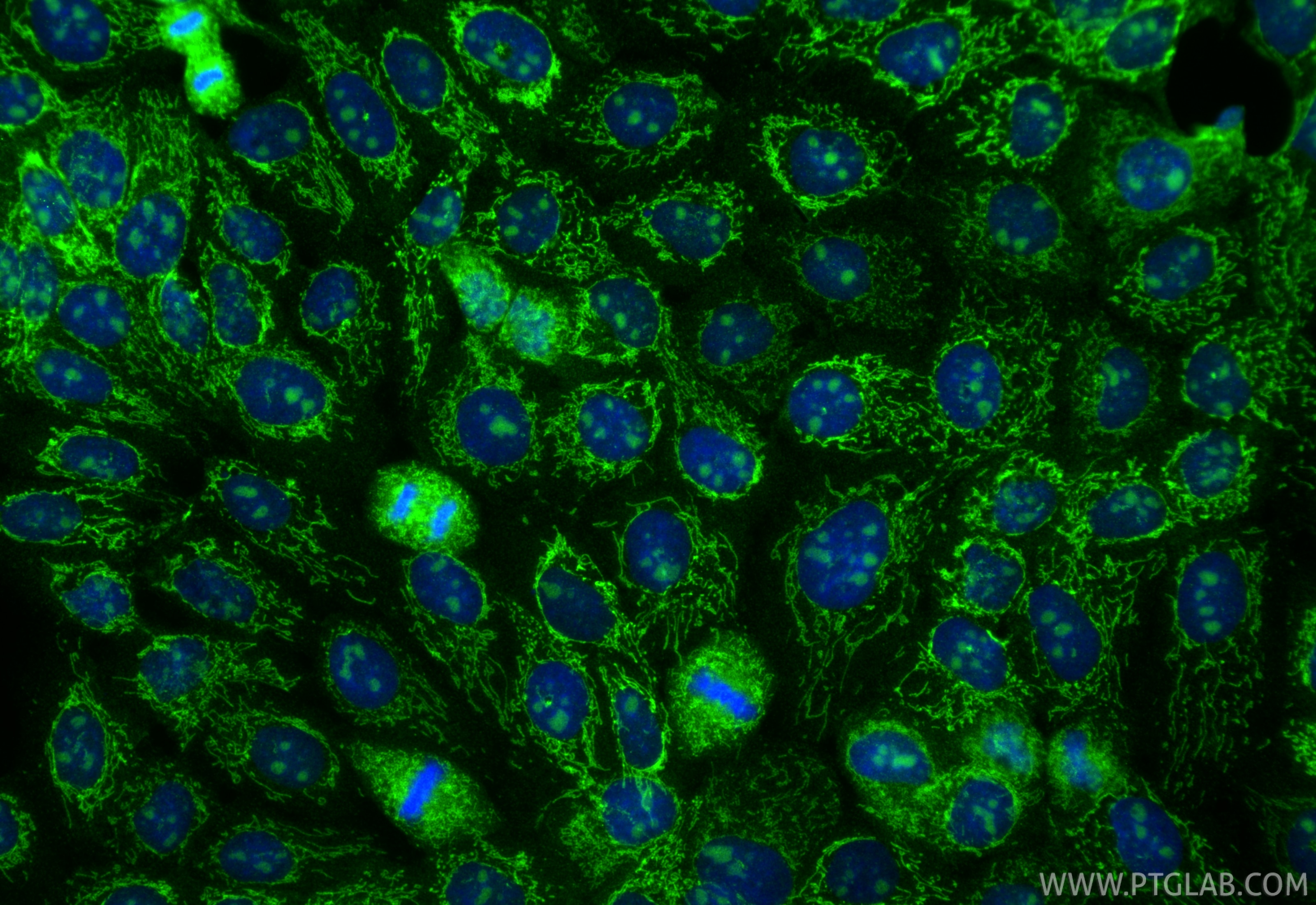 Immunofluorescent analysis of (4% PFA) fixed A431 cells using USP36 antibody (14783-1-AP) at dilution of 1:400 and CoraLite®488-Conjugated Goat Anti-Rabbit IgG(H+L) (SA00013-2). Immunofluorescence (IF) / fluorescent staining of A431 cells using USP36 Polyclonal antibody (14783-1-AP)