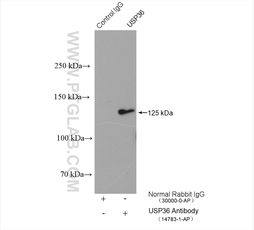 Immunoprecipitation (IP) experiment of Jurkat cells using USP36 Polyclonal antibody (14783-1-AP)