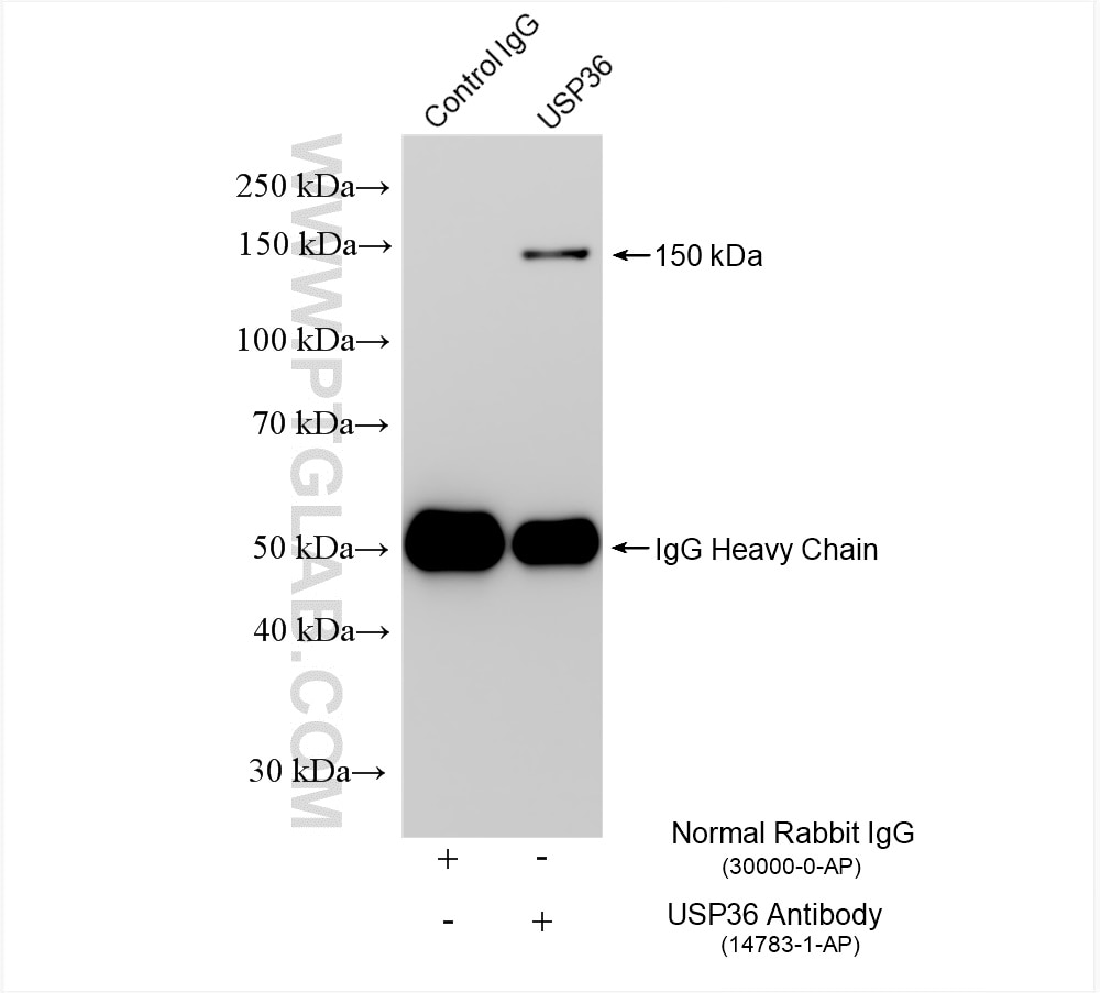 Immunoprecipitation (IP) experiment of Jurkat cells using human USP36 Polyclonal antibody (14783-1-AP)