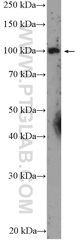 Western Blot (WB) analysis of Jurkat cells using USP36 Polyclonal antibody (14783-1-AP)