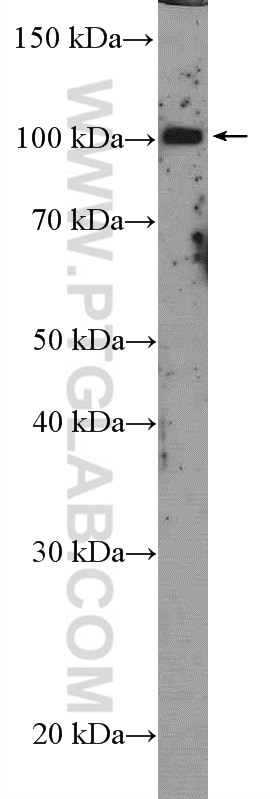 Western Blot (WB) analysis of HeLa cells using USP36 Polyclonal antibody (14783-1-AP)