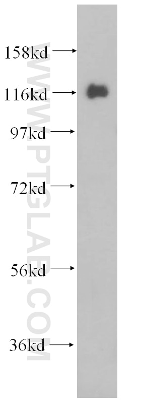 Western Blot (WB) analysis of Jurkat cells using USP36 Polyclonal antibody (14783-1-AP)