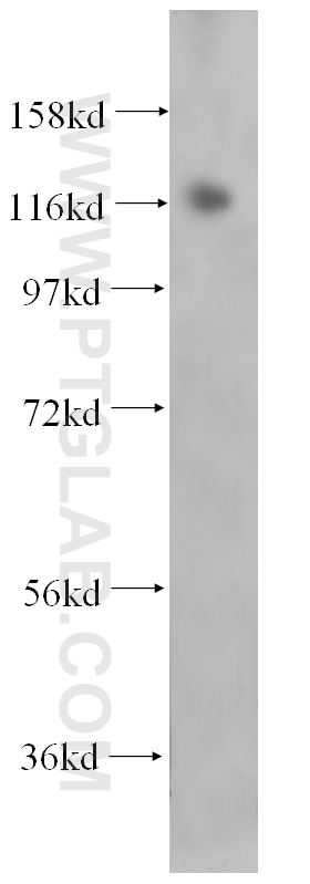 Western Blot (WB) analysis of HepG2 cells using USP36 Polyclonal antibody (14783-1-AP)