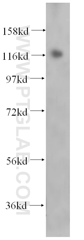 WB analysis of HepG2 using 14783-1-AP