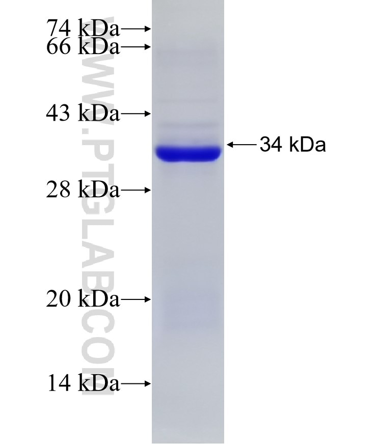 USP36 fusion protein Ag6426 SDS-PAGE