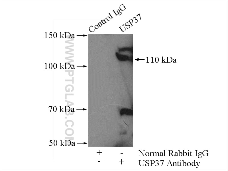 Immunoprecipitation (IP) experiment of mouse brain tissue using USP37 Polyclonal antibody (18465-1-AP)