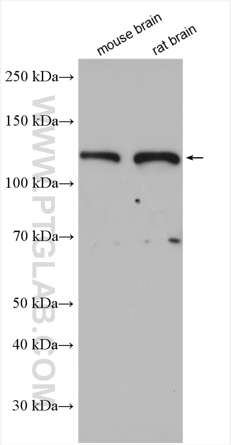 Western Blot (WB) analysis of various lysates using USP37 Polyclonal antibody (18465-1-AP)