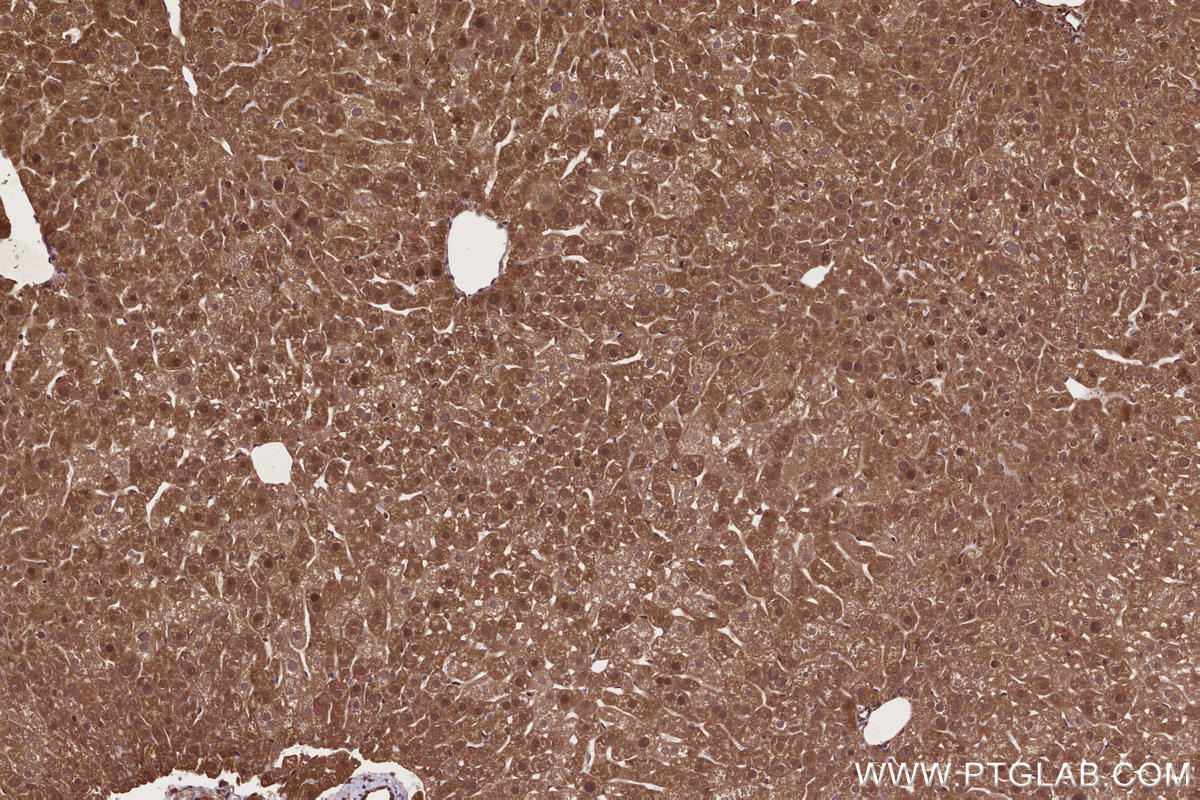IHC staining of mouse liver using 17767-1-AP Immunohistochemistry (IHC) staining of mouse liver tissue using USP38 Polyclonal antibody (17767-1-AP)