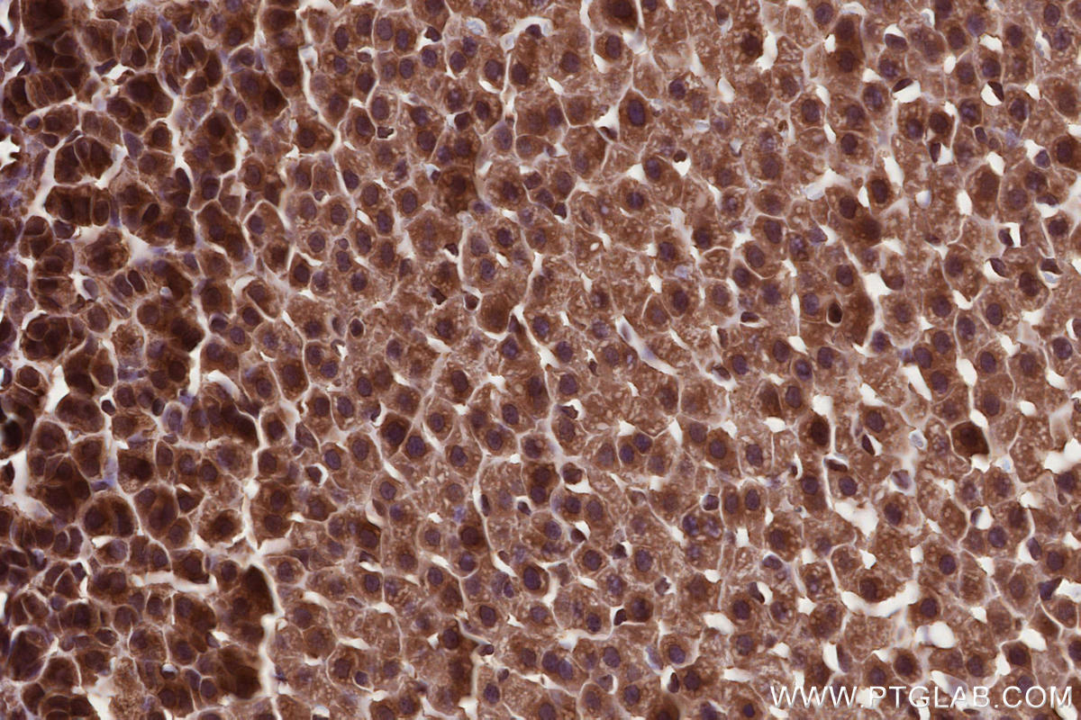 IHC staining of rat adrenal gland using 17767-1-AP Immunohistochemistry (IHC) staining of rat adrenal gland tissue using USP38 Polyclonal antibody (17767-1-AP)