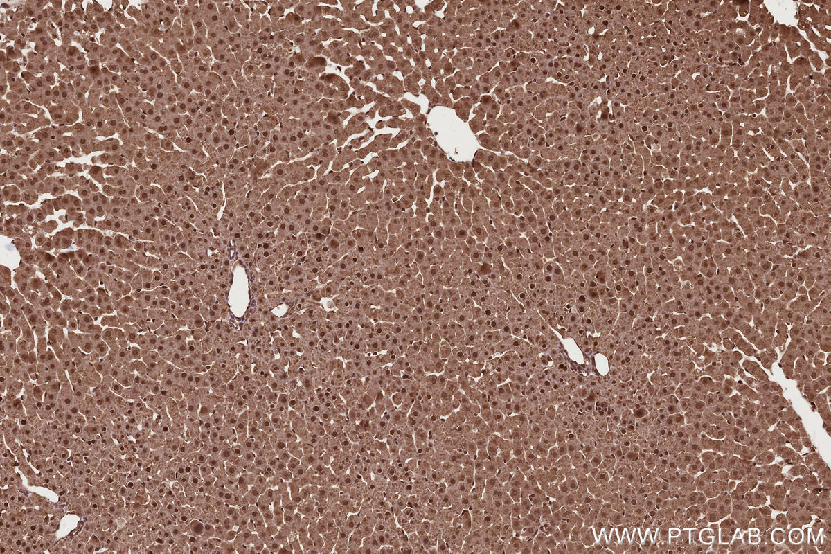IHC staining of rat liver using 17767-1-AP Immunohistochemistry (IHC) staining of rat liver tissue using USP38 Polyclonal antibody (17767-1-AP)