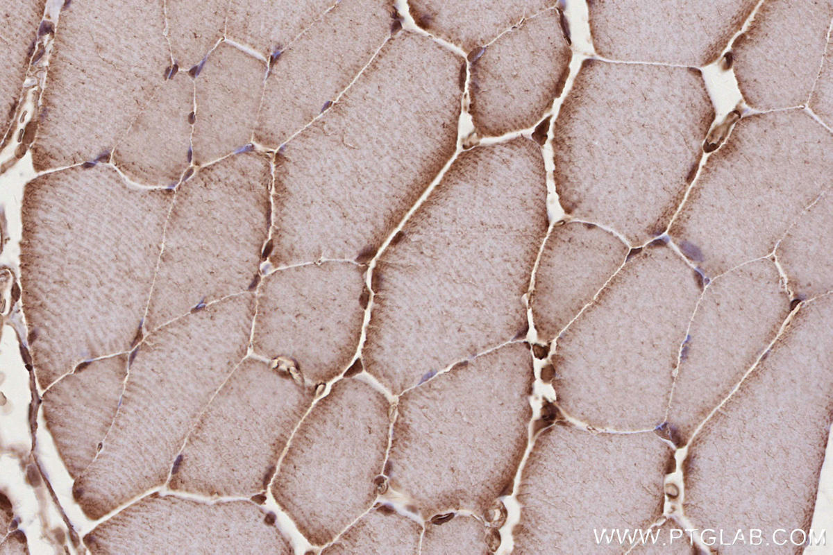 IHC staining of rat skeletal muscle using 17767-1-AP Immunohistochemistry (IHC) staining of rat skeletal muscle tissue using USP38 Polyclonal antibody (17767-1-AP)