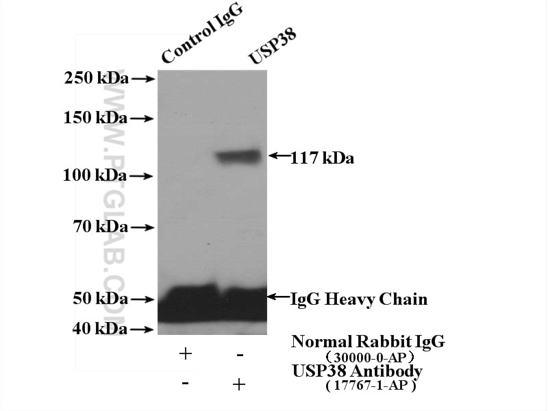 Immunoprecipitation (IP) experiment of K-562 cells using USP38 Polyclonal antibody (17767-1-AP)
