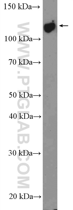 Western Blot (WB) analysis of HEK-293T cells using USP38 Polyclonal antibody (17767-1-AP)