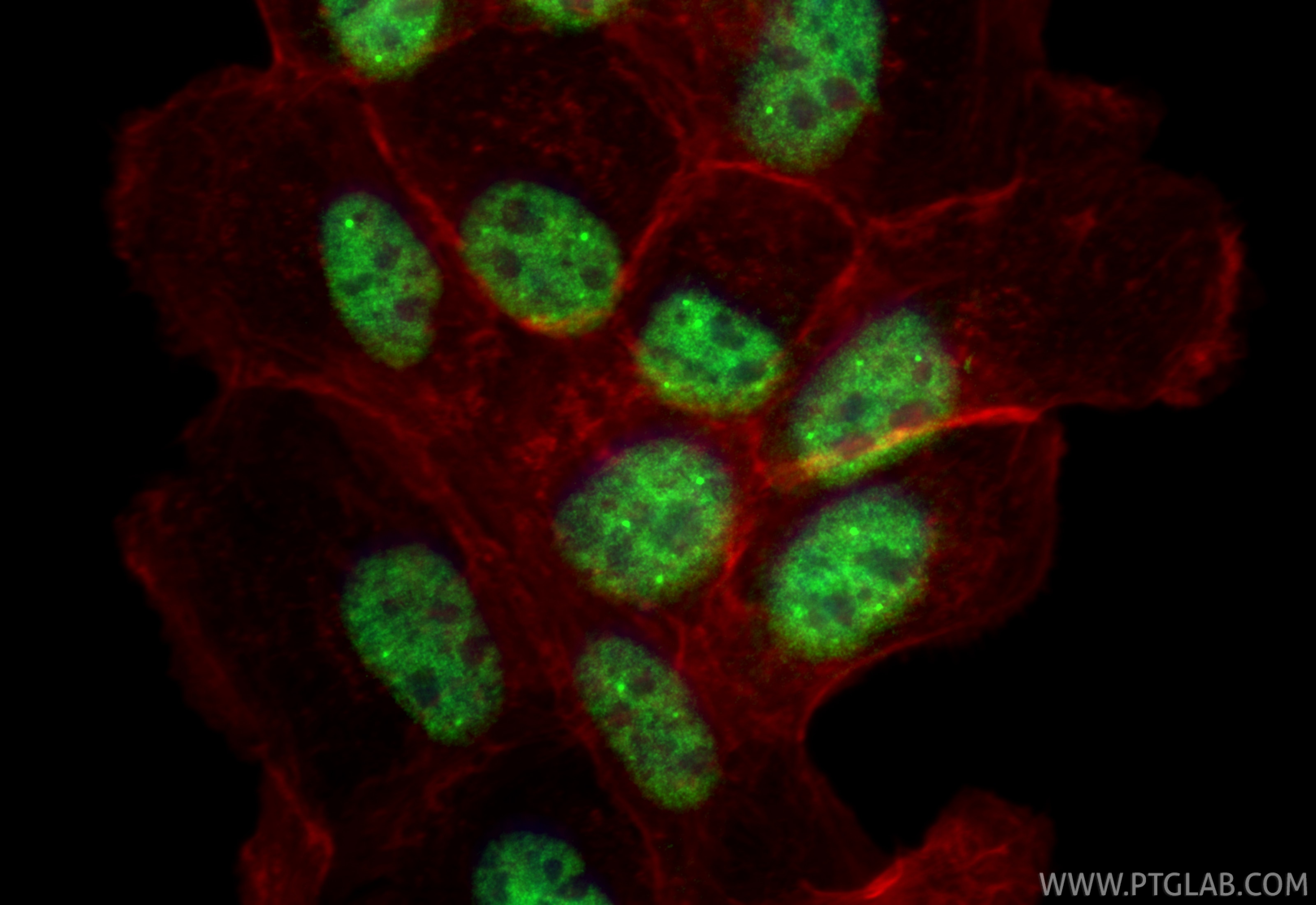 Immunofluorescence (IF) / fluorescent staining of A431 cells using USP39 Polyclonal antibody (23865-1-AP)