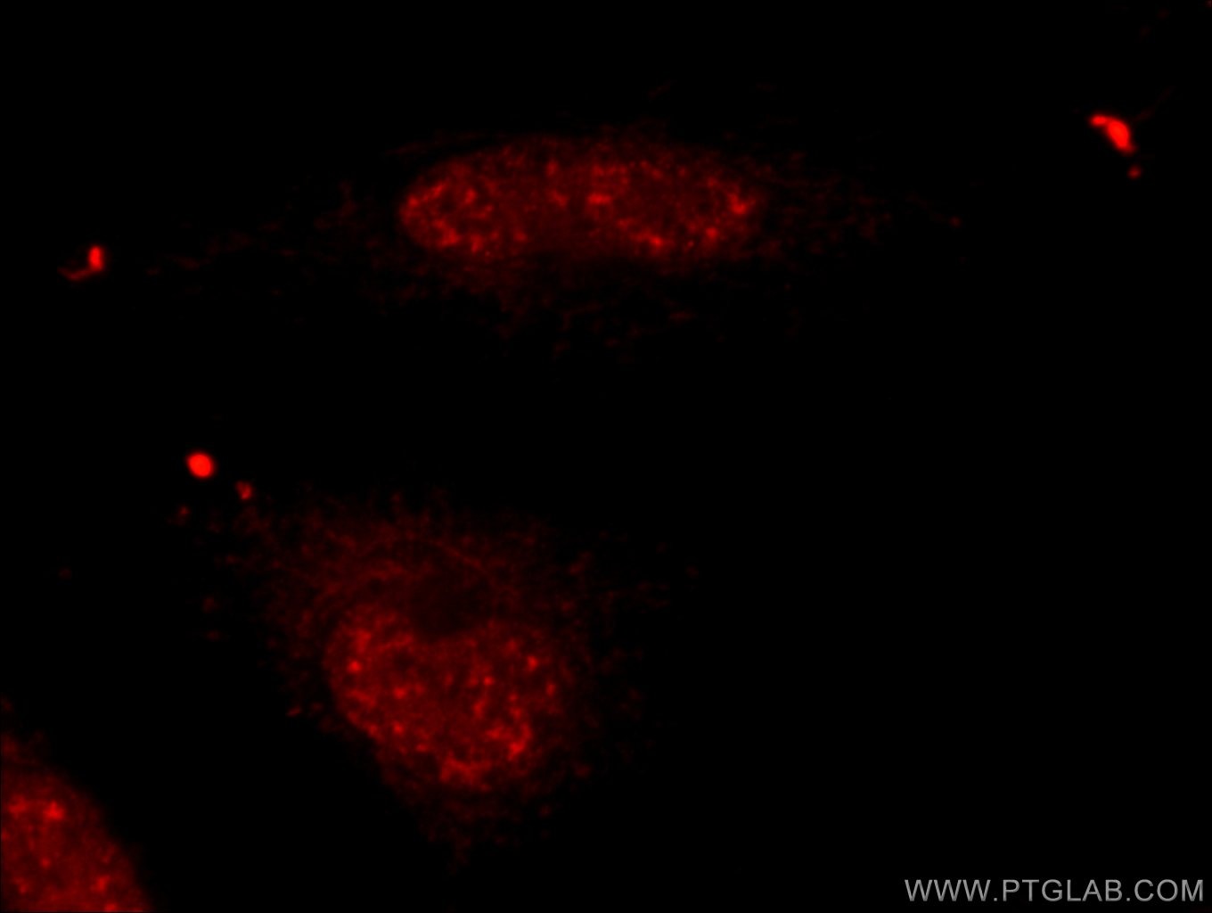 IF Staining of HUVEC using 23865-1-AP