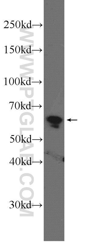 Western Blot (WB) analysis of HepG2 cells using USP39 Polyclonal antibody (23865-1-AP)