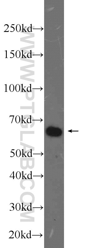 Western Blot (WB) analysis of K-562 cells using USP39 Polyclonal antibody (23865-1-AP)