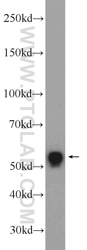 Western Blot (WB) analysis of HeLa cells using USP39 Polyclonal antibody (23865-1-AP)