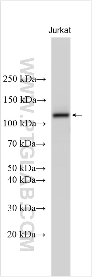 Western Blot (WB) analysis of various lysates using USP4 Polyclonal antibody (24976-1-AP)