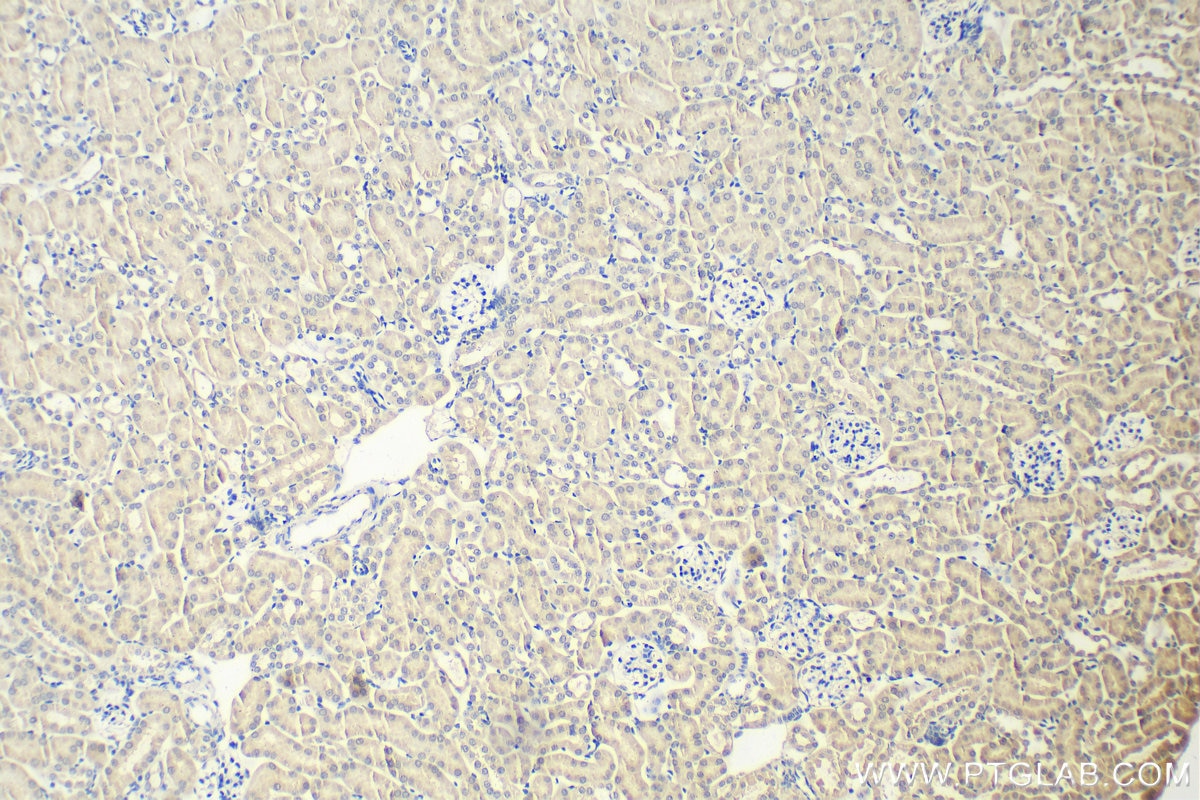 Immunohistochemistry (IHC) staining of mouse kidney tissue using USP4 Monoclonal antibody (66822-1-Ig)