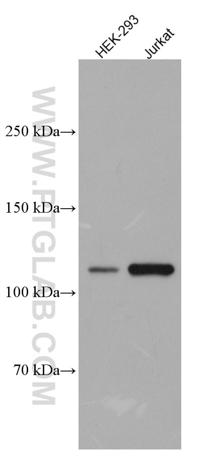 Western Blot (WB) analysis of various lysates using USP4 Monoclonal antibody (66822-1-Ig)