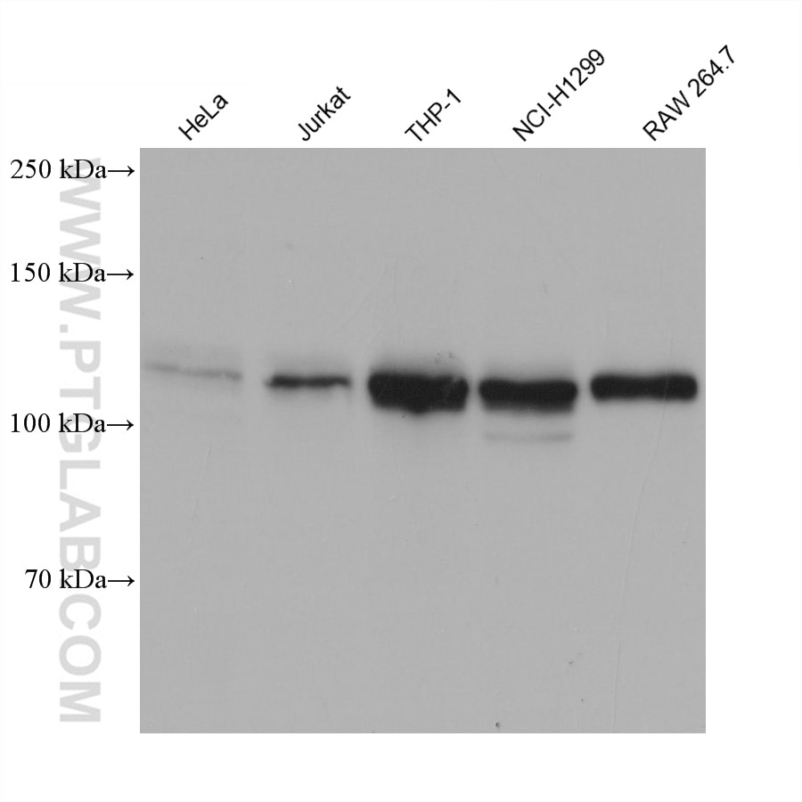 Western Blot (WB) analysis of various lysates using USP4 Monoclonal antibody (66822-1-Ig)