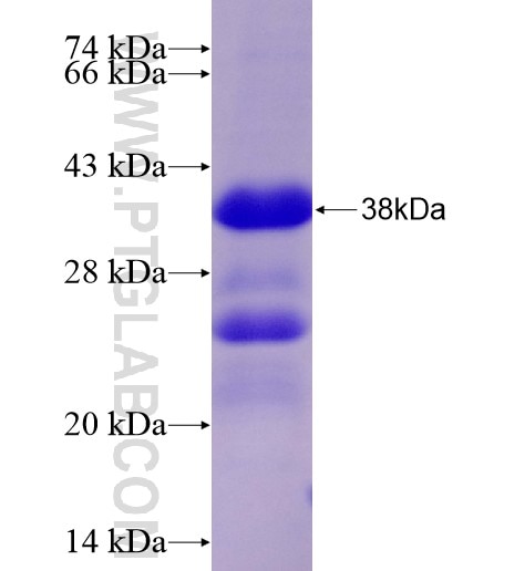 USP4 fusion protein Ag28297 SDS-PAGE