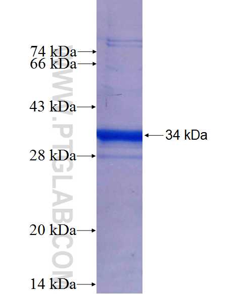 USP40 fusion protein Ag25976 SDS-PAGE