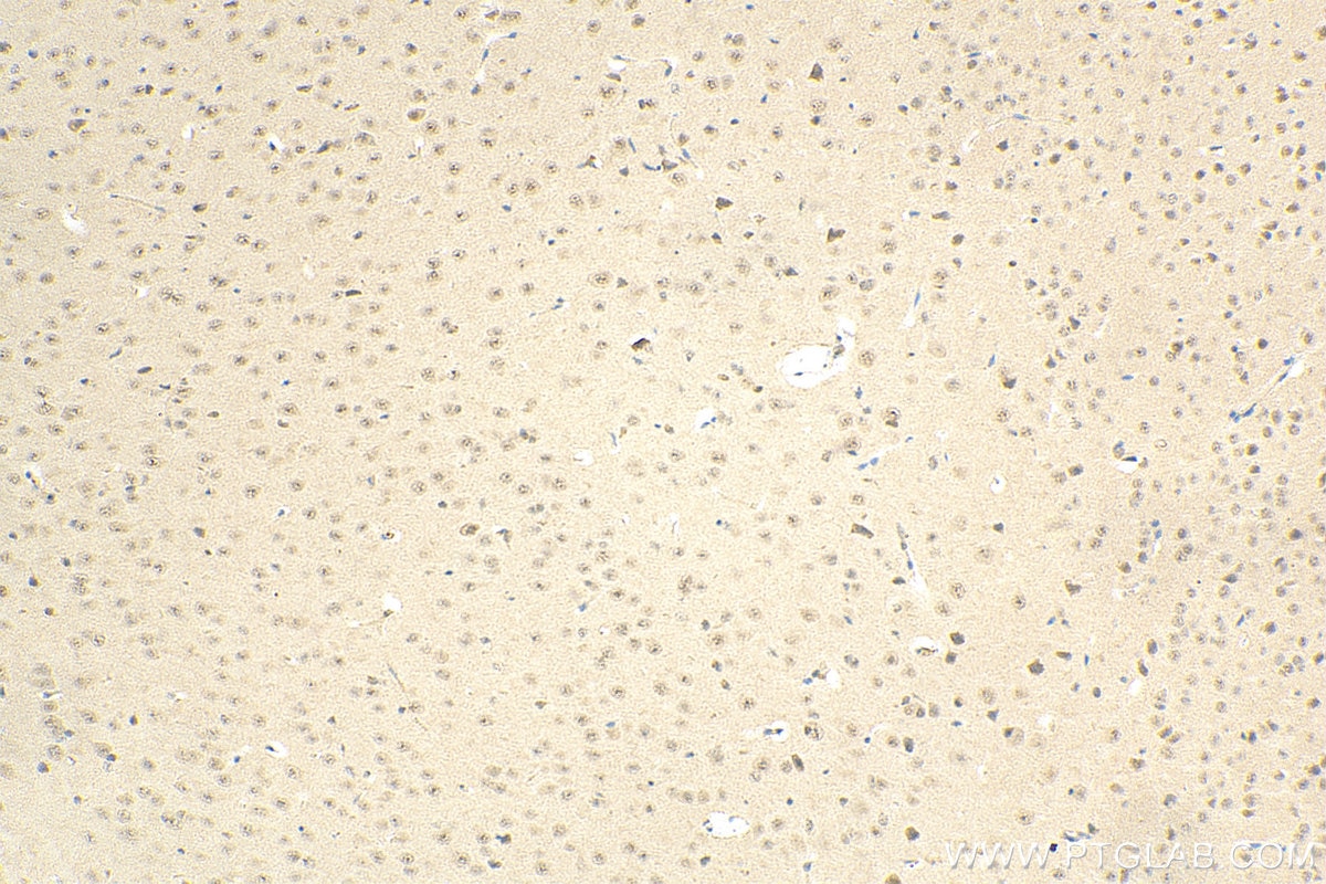 Immunohistochemistry (IHC) staining of mouse brain tissue using USP42 Polyclonal antibody (18811-1-AP)