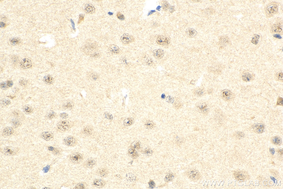 Immunohistochemistry (IHC) staining of mouse brain tissue using USP42 Polyclonal antibody (18811-1-AP)