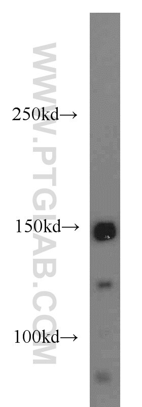 Western Blot (WB) analysis of mouse brain tissue using USP42 Polyclonal antibody (18811-1-AP)