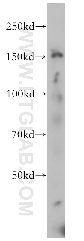 Western Blot (WB) analysis of mouse brain tissue using USP42 Polyclonal antibody (18811-1-AP)