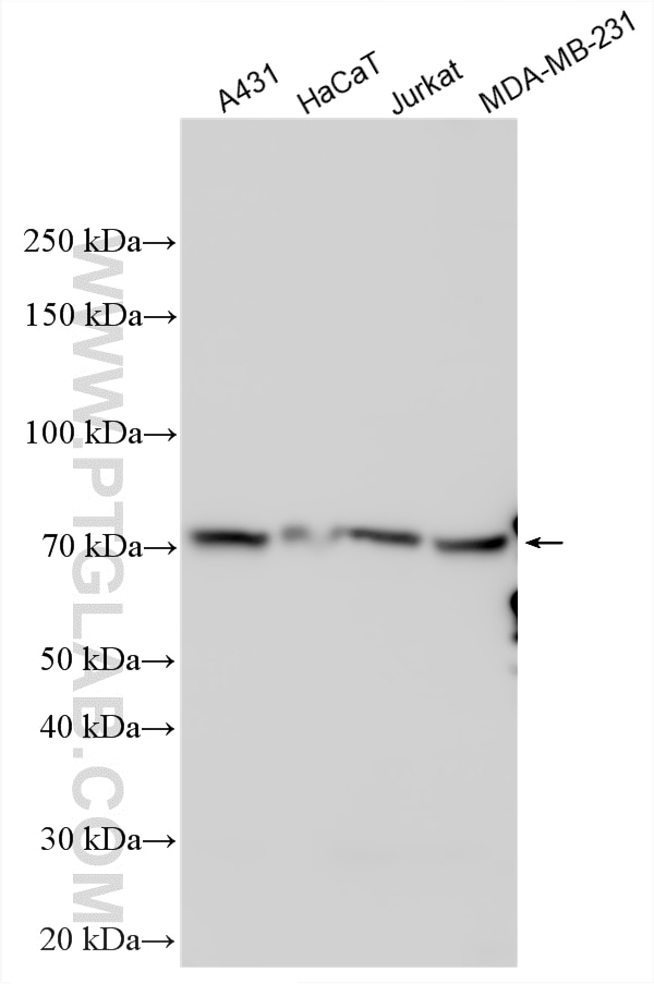 Various lysates were subjected to SDS PAGE followed by western blot with 32375-1-AP (USP43 antibody) at dilution of 1:2000 incubated at room temperature for 1.5 hours. Western Blot (WB) analysis of various lysates using USP43 Polyclonal antibody (32375-1-AP)