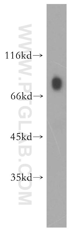 Western Blot (WB) analysis of human placenta tissue using USP44 Polyclonal antibody (15521-1-AP)