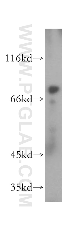 Western Blot (WB) analysis of mouse testis tissue using USP44 Polyclonal antibody (15521-1-AP)