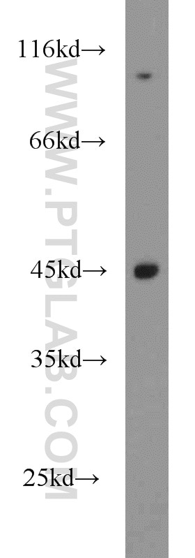Western Blot (WB) analysis of SGC-7901 cells using USP45 Polyclonal antibody (15866-1-AP)