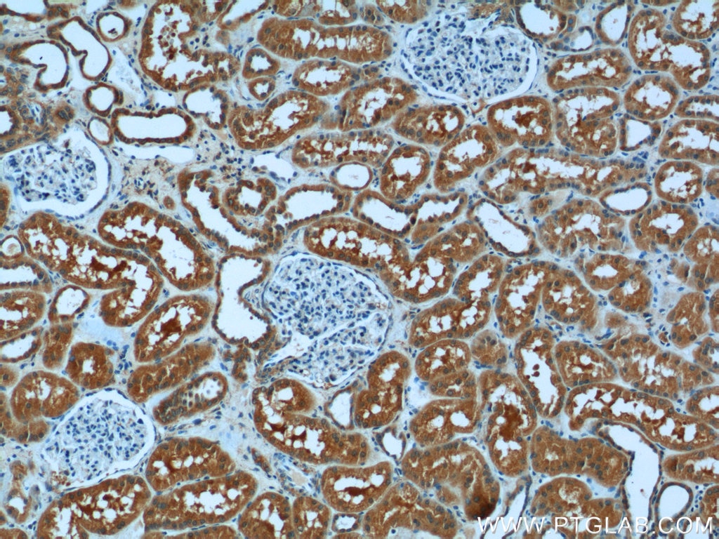 Immunohistochemistry (IHC) staining of human kidney tissue using USP46 Polyclonal antibody (13502-1-AP)