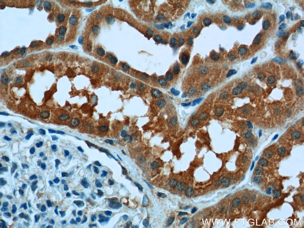 Immunohistochemistry (IHC) staining of human kidney tissue using USP46 Polyclonal antibody (13502-1-AP)