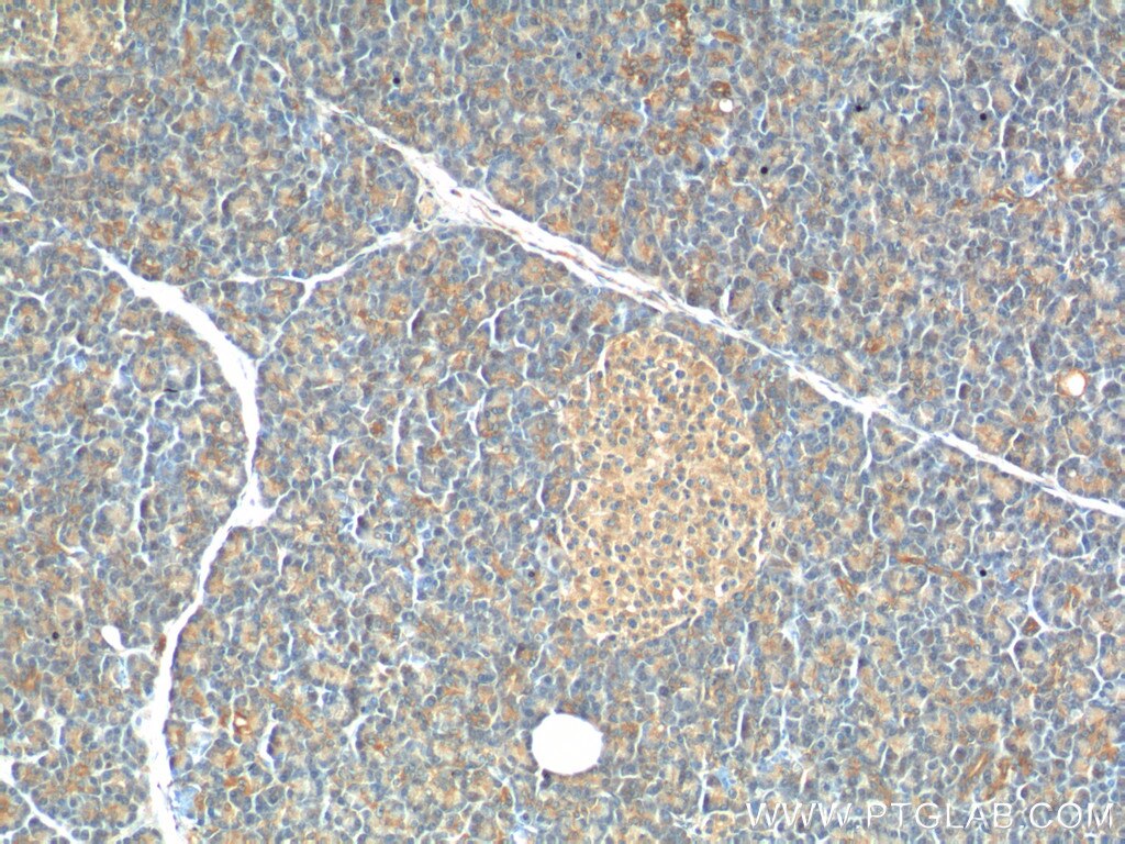 Immunohistochemistry (IHC) staining of human pancreas tissue using USP46 Polyclonal antibody (13502-1-AP)