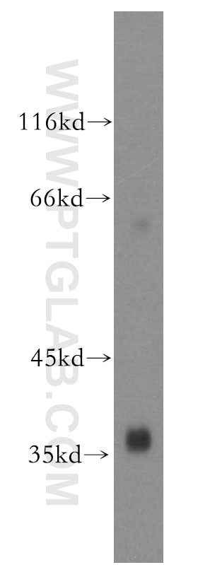 Western Blot (WB) analysis of human kidney tissue using USP46 Polyclonal antibody (13502-1-AP)