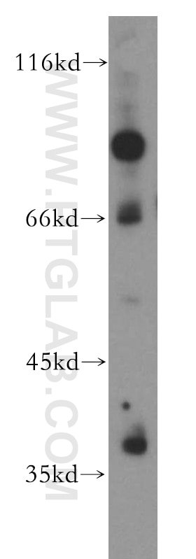 Western Blot (WB) analysis of mouse pancreas tissue using USP46 Polyclonal antibody (13502-1-AP)