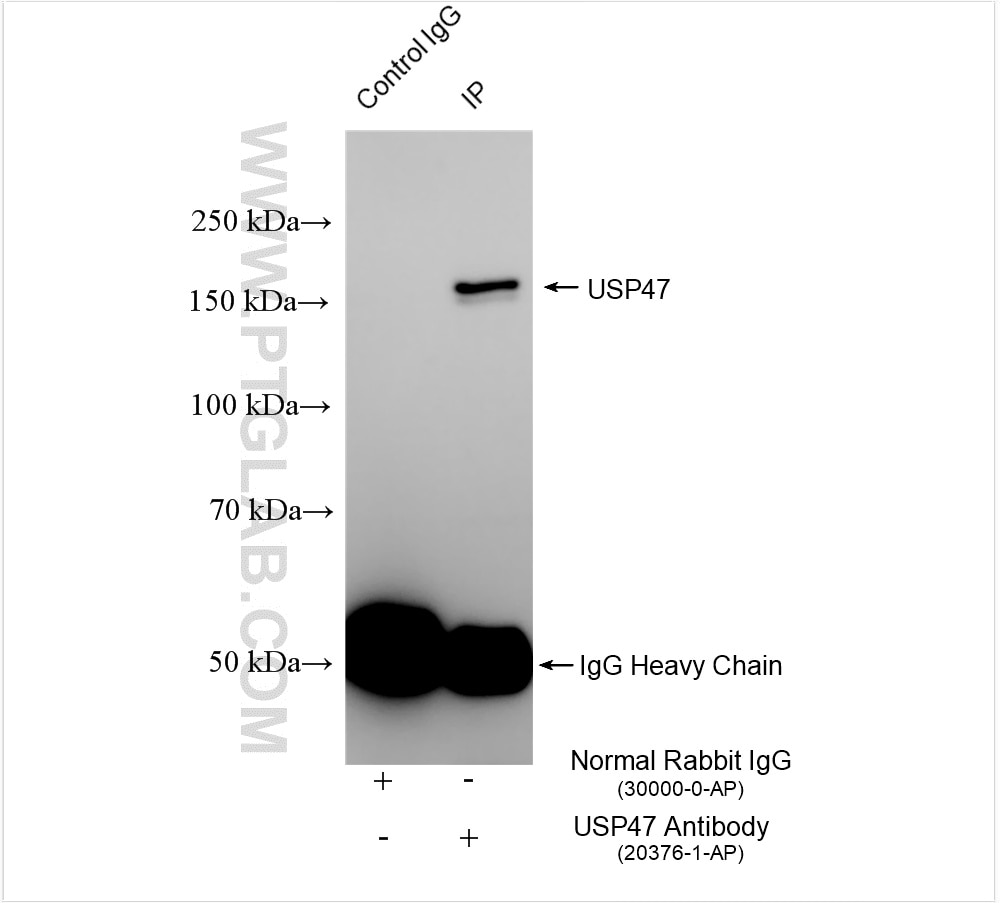 IP experiment of HeLa using 20376-1-AP Immunoprecipitation (IP) experiment of HeLa cells using USP47 Polyclonal antibody (20376-1-AP)
