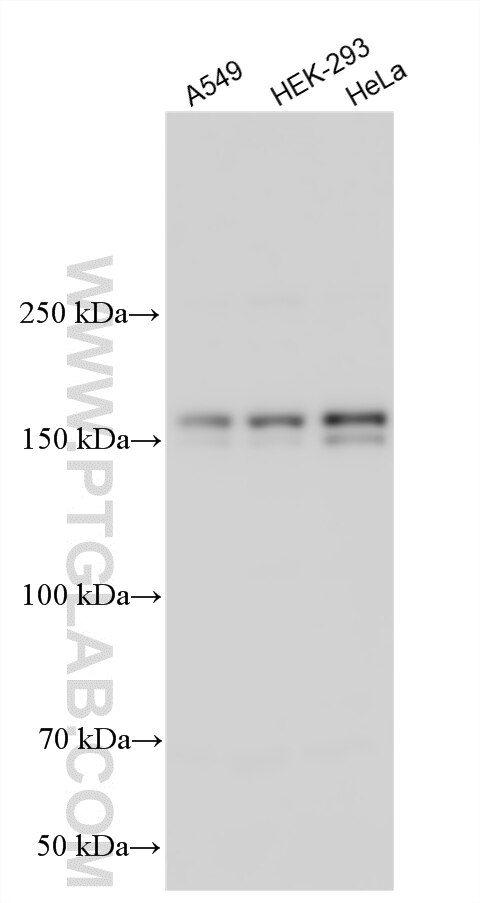 WB analysis using 20376-1-AP Western Blot (WB) analysis of various lysates using USP47 Polyclonal antibody (20376-1-AP)