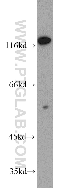 Western Blot (WB) analysis of HeLa cells using USP48 Polyclonal antibody (12076-1-AP)