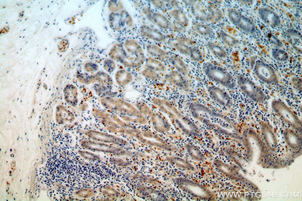 Immunohistochemistry (IHC) staining of human stomach tissue using USP49 Polyclonal antibody (18066-1-AP)