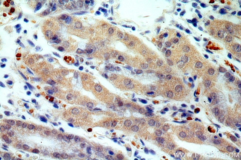 Immunohistochemistry (IHC) staining of human stomach tissue using USP49 Polyclonal antibody (18066-1-AP)